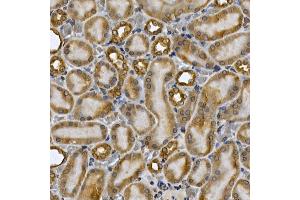 Immunohistochemistry of paraffin-embedded rat kidney using [KO Validated] ST Rabbit pAb (ABIN6132553, ABIN6148568, ABIN6148571 and ABIN6215503) at dilution of 1:250 (40x lens). (STAT3 antibody  (AA 640-770))