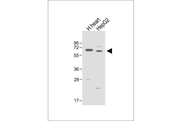 Asparaginase anticorps  (AA 165-193)