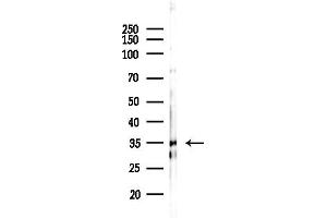 anti-Sarcoglycan, gamma (35kDa Dystrophin-Associated Glycoprotein) (SGCG) (C-Term) antibody