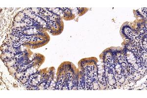 Immunohistochemistry (IHC) image for anti-Trefoil Factor 2 (TFF2) (AA 25-127) antibody (ABIN7432517)