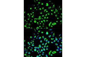 Immunofluorescence analysis of HeLa cells using YWHAQ antibody (ABIN5971388). (14-3-3 theta antibody)