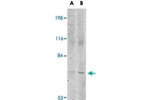 Western blot analysis of JPH1 in 293 cell lysate with JPH1 polyclonal antibody  at (A) 1 and (B) 2 ug/mL . (Junctophilin 1 antibody  (C-Term))