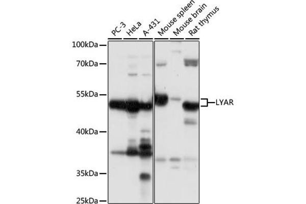 LYAR anticorps  (AA 10-160)
