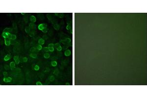 Peptide - +Immunofluorescence analysis of A549 cells, using E-cadherin antibody. (E-cadherin antibody)