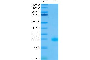 Biotinylated IL-4 on Tris-Bis PAGE under reduced condition. (IL-4 Protein (AA 25-153) (His-Avi Tag,Biotin))