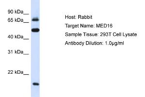 Host: Rabbit Target Name: MED16 Sample Type: 293T Whole Cell lysates Antibody Dilution: 1. (MED16 antibody  (Middle Region))