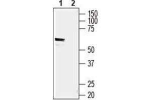 Solute Carrier Family 2 (Facilitated Glucose/fructose Transporter), Member 5 (SLC2A5) peptide