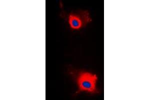 Immunofluorescent analysis of IRS1 (pS636) staining in MCF7 cells. (IRS1 antibody  (pSer636))