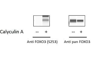 HeLa cells were treated or untreated with Calyculin A. (FOXO3 ELISA Kit)