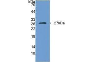 Detection of Recombinant MYH1, Human using Polyclonal Antibody to Myosin Heavy Chain 1 (MYH1) (MYH1 antibody  (AA 585-794))