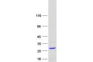 Western Blotting (WB) image for Ubiquitin-Conjugating Enzyme E2G 1 (Ube2g1) protein (Myc-DYKDDDDK Tag) (ABIN2734828)