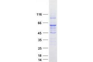 Western Blotting (WB) image for ATP-Binding Cassette, Sub-Family D (Ald), Member 4 (ABCD4) (Transcript Variant 1) protein (Myc-DYKDDDDK Tag) (ABIN2714265)