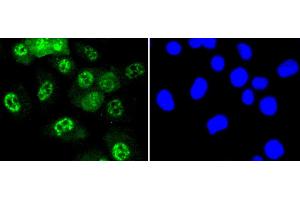 Immunofluorescence analysis of HUVEC cells using Phospho-JNK1/2/3-T183/T183/T221 antibody (abx125450). (SMAD2 antibody  (pThr183, pThr221))