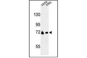 Western blot analysis of GFPT2 / GFAT2 Antibody (Center) in A2058, K562 cell line lysates (35ug/lane).
