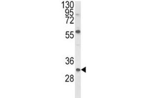Western blot analysis of GDNF antibody and mouse NIH3T3 lysate.