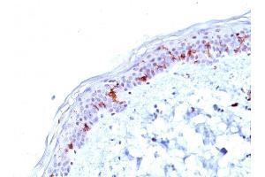 Formalin-fixed, paraffin-embedded human Skin stained with CD1a Mouse Monoclonal Antibody (O10). (CD1a antibody)