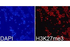 Immunofluorescence (IF) image for anti-Histone 3 (H3) (H3K27me3) antibody (ABIN1873002) (Histone 3 antibody  (H3K27me3))