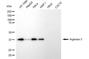 Western blotting analysis using arginase 2 antibody (ABIN7797645). (ARG2 antibody)