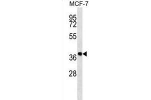 Western Blotting (WB) image for anti-Dehydrogenase/reductase (SDR Family) Member 7B (DHRS7B) antibody (ABIN2997289) (DHRS7B antibody)
