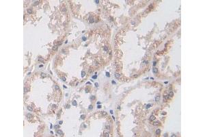 Used in DAB staining on fromalin fixed paraffin- embedded kidney tissue (BPGM antibody  (AA 29-242))