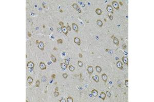 Immunohistochemistry of paraffin-embedded rat brain using PDE1B antibody (ABIN5971128) at dilution of 1/100 (40x lens).