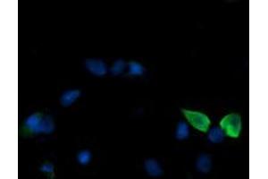 Image no. 2 for anti-Mitogen-Activated Protein Kinase Kinase 3 (MAP2K3) antibody (ABIN1499399) (MAP2K3 antibody)