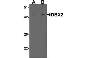 Western blot analysis of DBX2 in human kidney tissue lysate with DBX2 antibody at (A) 1 and (B) 2 ug/mL. (DBX2 antibody  (N-Term))