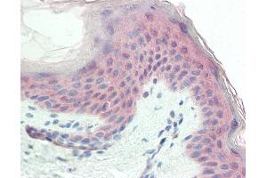 Anti-TRIM29 antibody IHC staining of human skin. (TRIM29 antibody  (C-Term))