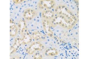 Immunohistochemistry of paraffin-embedded Rat kidney using LETMD1 Polyclonal Antibody at dilution of 1:100 (40x lens). (LETMD1 antibody)