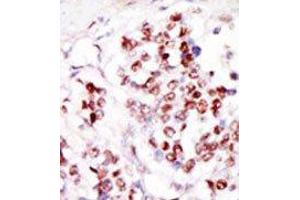 Image no. 2 for anti-Tousled-Like Kinase 1 (TLK1) (C-Term) antibody (ABIN360576) (TLK1 antibody  (C-Term))