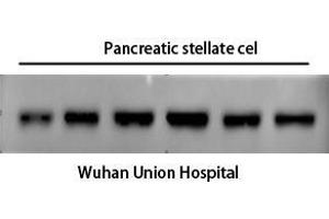 Western Blot (WB) analysis: Please contact us for more details. (alpha-SMA antibody)