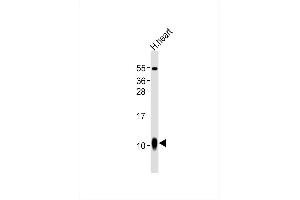 Anti--A1 Antibody at 1:1000 dilution + human heart lysates Lysates/proteins at 20 μg per lane. (S100A1 antibody)