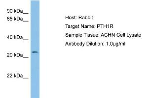 Host: Rabbit Target Name: PTH1R Sample Type: ACHN Whole Cell lysates Antibody Dilution: 1. (PTH1R antibody  (N-Term))