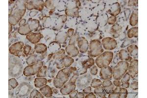 Image no. 1 for anti-F-Box and Leucine-Rich Repeat Protein 18 (FBXL18) (AA 1-111) antibody (ABIN466244) (FBXL18 antibody  (AA 1-111))