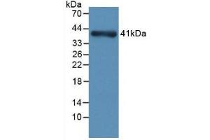 Detection of Recombinant NPHN, Rat using Monoclonal Antibody to Nephrin (NPHN) (Nephrin antibody  (AA 39-106))
