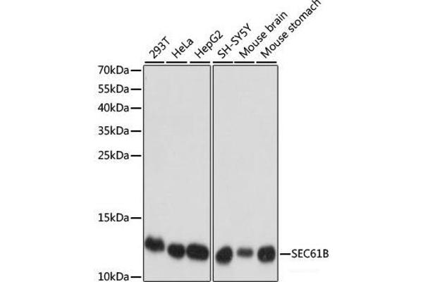 SEC61B anticorps