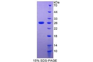 SDS-PAGE (SDS) image for Metalloproteinase Inhibitor 2 (TIMP2) (AA 27-220) protein (His tag) (ABIN2126967)