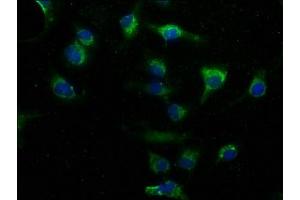 Immunofluorescence staining of U251 cells with ABIN7163226 at 1:50, counter-stained with DAPI. (PITPNA antibody  (AA 1-270))