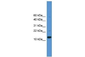 WB Suggested Anti-CASP1  Antibody Titration: 0. (Caspase 1 antibody  (Middle Region))