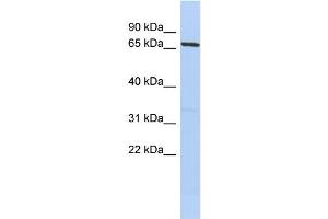 WB Suggested Anti-PRDM1 Antibody Titration:  0. (PRDM1 antibody  (Middle Region))