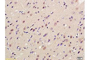 Formalin-fixed and paraffin embedded rat brain labeled with Anti-mGluR4 Polyclonal Antibody, Unconjugated (ABIN735998) at 1:200 followed by conjugation to the secondary antibody (GRM4/6 antibody  (AA 301-400))