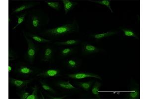 Immunofluorescence of purified MaxPab antibody to FANCF on HeLa cell. (FANCF antibody  (AA 1-374))