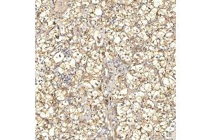 IHC analysis of TXNDC5 using anti-TXNDC5 antibody (ABIN7599699). (TXNDC5 antibody  (AA 109-403))