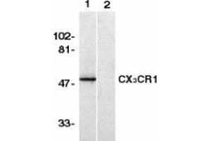 Image no. 1 for anti-Chemokine (C-X3-C Motif) Receptor 1 (CX3CR1) (AA 2-21) antibody (ABIN201961) (CX3CR1 antibody  (AA 2-21))