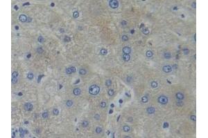 Detection of PFKP in Human Liver Tissue using Polyclonal Antibody to Phosphofructokinase, Platelet (PFKP) (PFKP antibody  (AA 553-753))