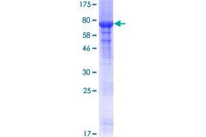 PRMT2 Protein (AA 1-433) (GST tag)