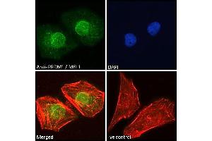 Immunofluorescence (IF) image for anti-PR Domain Containing 1, with ZNF Domain (PRDM1) (Internal Region) antibody (ABIN571072)