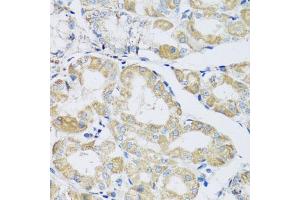 Immunohistochemistry of paraffin-embedded human stomach using ATPIF1 antibody (ABIN5972942) at dilution of 1/100 (40x lens). (ATPase Inhibitory Factor 1 antibody)