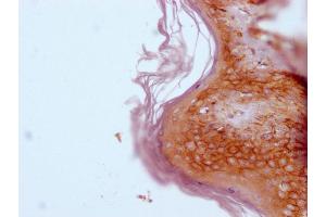 IHC image of ABIN7180745 diluted at 1:100 and staining in paraffin-embedded human skin tissue performed on a Leica BondTM system. (CD44 antibody)