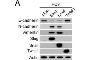 Snail- and Slug-induced EMT promoted drug resistance of parental PC9 and HCC827 cells. (TWIST1 antibody  (Center))